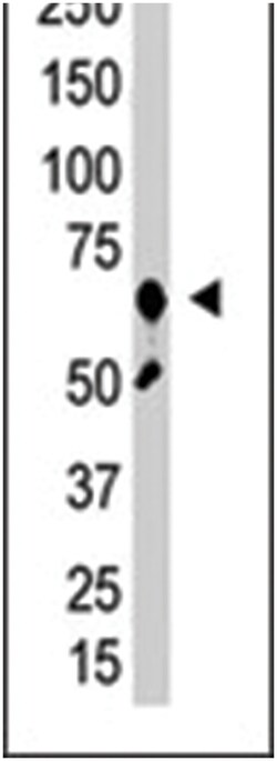 ZMIZ1 Rabbit anti-Human, Polyclonal Antibody, Abnova 400&mu;L; Unlabeled:Antibodies,