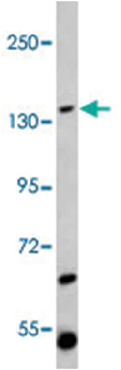 ST5, Rabbit, Polyclonal Antibody, Abnova 400&mu;L; Unlabeled:Antibodies,