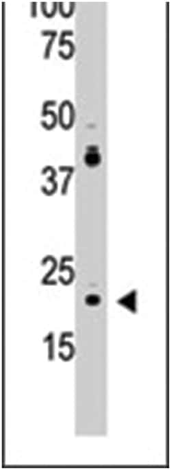 PDAP1, Rabbit, Polyclonal Antibody, Abnova 400&mu;L; Unlabeled:Antibodies,
