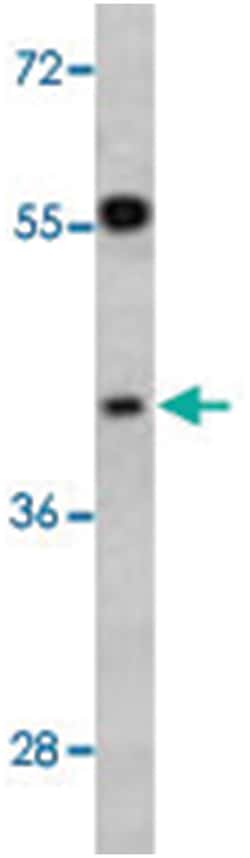 TOB2, Rabbit, Polyclonal Antibody, Abnova 400 &mu;L | Buy Online | Abnova Corporation | Fisher Scientific