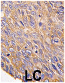 TOB2, Rabbit, Polyclonal Antibody, Abnova 400 &mu;L | Buy Online | Abnova Corporation | Fisher Scientific