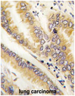 AGR2 Rabbit anti-Human, Polyclonal Antibody, Abnova 400&mu;L; Unlabeled:Antibodies,