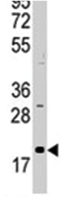 AGR2 Rabbit anti-Human, Polyclonal Antibody, Abnova 400&mu;L; Unlabeled:Antibodies,