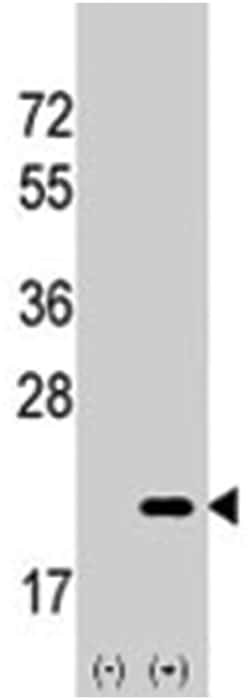 AGR2 Rabbit anti-Human, Polyclonal Antibody, Abnova 400&mu;L; Unlabeled:Antibodies,
