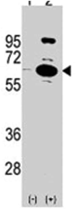 PARP6 Rabbit anti-Human, Polyclonal Antibody, Abnova 400 &mu;L | Buy Online | Abnova Corporation | Fisher Scientific