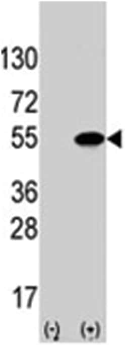 ATF4 Rabbit anti-Human, Polyclonal Antibody, Abnova 400 &mu;L | Buy Online | Abnova Corporation | Fisher Scientific