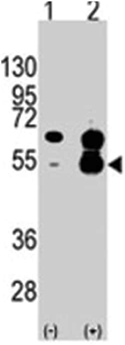 VEGFA Rabbit anti-Human, Polyclonal Antibody, Abnova 400 &mu;L | Buy Online | Abnova Corporation | Fisher Scientific