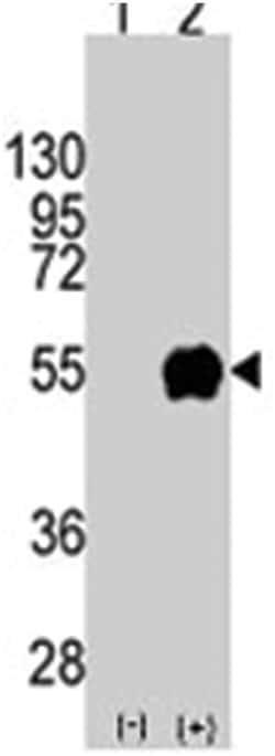 CD14 Rabbit anti-Human, Polyclonal Antibody, Abnova 400&mu;L; Unlabeled:Antibodies,