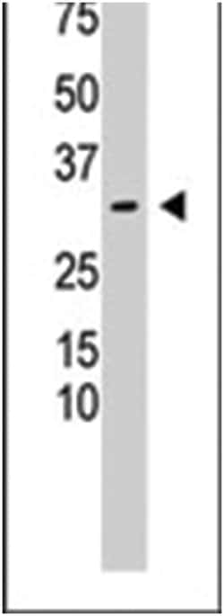 RCAN3, Rabbit, Polyclonal Antibody, Abnova 400 &mu;L | Buy Online | Abnova Corporation | Fisher Scientific