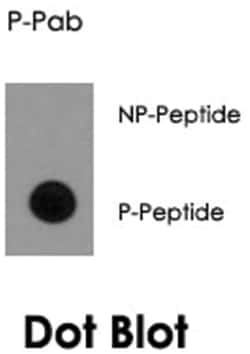 LRP1, Rabbit, Polyclonal Antibody, Abnova 400 &mu;L | Buy Online | Abnova Corporation | Fisher Scientific