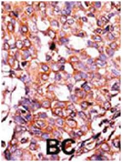 LRP1, Rabbit, Polyclonal Antibody, Abnova 400 &mu;L | Buy Online | Abnova Corporation | Fisher Scientific