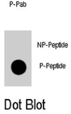 TERT (phospho S1125), Rabbit anti-Human, Polyclonal Antibody, Abnova 400 &mu;L | Buy Online | Abnova Corporation | Fisher Scientific