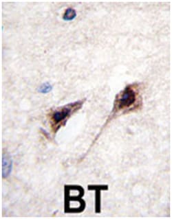 MEF2C Rabbit anti-Human, Polyclonal Antibody, Abnova 400&mu;L; Unlabeled:Antibodies,