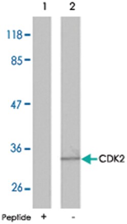 CDK2 Rabbit anti-Human, Mouse, Rat, Polyclonal Antibody, Abnova 100&mu;g;