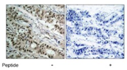 FOXO1 Rabbit anti-Human, Mouse, Rat, Polyclonal Antibody, Abnova 100 &mu;g | Buy Online | Abnova | Fisher Scientific