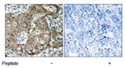FOXO1 Rabbit anti-Human, Mouse, Rat, Polyclonal Antibody, Abnova 100 &mu;g | Buy Online | Abnova Corporation | Fisher Scientific