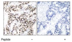 MYC Rabbit anti-Human, Mouse, Rat, Polyclonal Antibody, Abnova 100 &mu;g | Buy Online | Abnova Corporation | Fisher Scientific