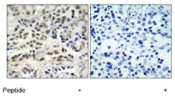 CDKN1B Rabbit anti-Human, Mouse, Rat, Polyclonal Antibody, Abnova 100&mu;g;
