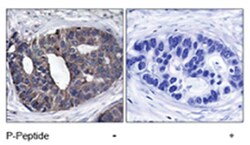 DOK1 Rabbit anti-Human, Mouse, Rat, Polyclonal Antibody, Abnova 100&mu;g;