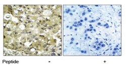 KDR Rabbit anti-Human, Mouse, Rat, Polyclonal Antibody, Abnova 100&mu;g;