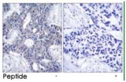 ZAP70 Rabbit anti-Human, Mouse, Rat, Polyclonal Antibody, Abnova 100 &mu;g | Buy Online | Abnova Corporation | Fisher Scientific