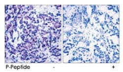 JUND (phospho S255), Rabbit anti-Human, Mouse, Rat, Polyclonal Antibody,