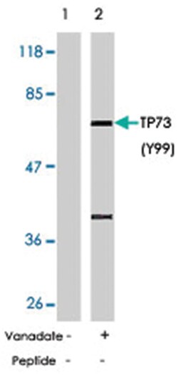 TP73 (phospho Y99), Rabbit anti-Human, Mouse, Rat, Polyclonal Antibody, Abnova 100 &mu;g | Buy Online | Abnova | Fisher Scientific
