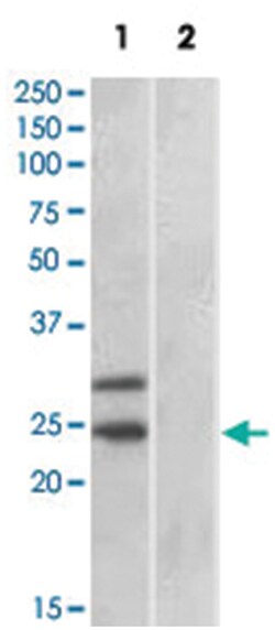 SOCS1, Goat, Polyclonal Antibody, Abnova 100&mu;g; Unlabeled:Antibodies