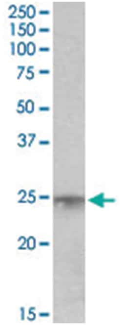 MSC, Goat, Polyclonal Antibody, Abnova 100&mu;g; Unlabeled:Antibodies,
