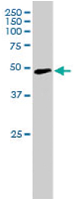 NCF1 Goat anti-Human, Polyclonal Antibody, Abnova 100 &mu;g | Buy Online | Abnova Corporation | Fisher Scientific