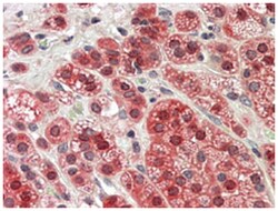 MTR, Goat, Polyclonal Antibody, Abnova 100&mu;g; Unlabeled:Antibodies,