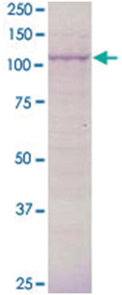 BCAR3, Goat, Polyclonal Antibody, Abnova 100 &mu;g | Buy Online | Abnova | Fisher Scientific