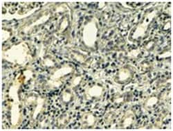 TNS1, Goat, Polyclonal Antibody, Abnova 100 &mu;g | Buy Online | Abnova Corporation | Fisher Scientific