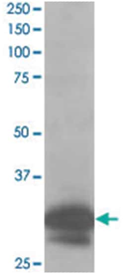 CAPZB, Goat, Polyclonal Antibody, Abnova 100 &mu;g | Buy Online | Abnova Corporation | Fisher Scientific