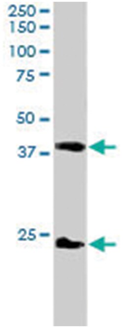 SET, Goat, Polyclonal Antibody, Abnova 100 &mu;g | Buy Online | Abnova Corporation | Fisher Scientific