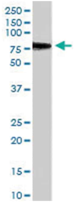 MTA1, Goat, Polyclonal Antibody, Abnova 100 &mu;g | Buy Online | Abnova | Fisher Scientific