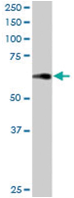 BAIAP2 Goat anti-Human, Polyclonal Antibody, Abnova 100&mu;g; Unlabeled:Antibodies,