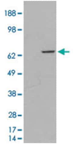 MTM1, Goat, Polyclonal Antibody, Abnova 100&mu;g; Unlabeled:Antibodies,