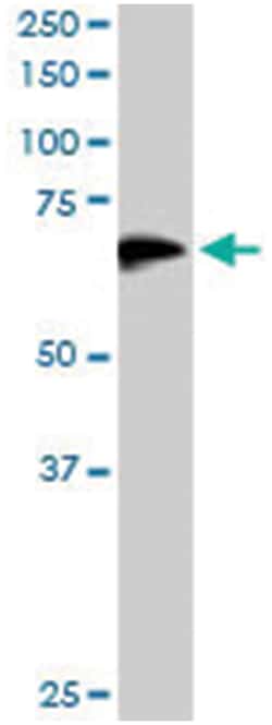 DOK3, Goat, Polyclonal Antibody, Abnova 100&mu;g; Unlabeled:Antibodies,