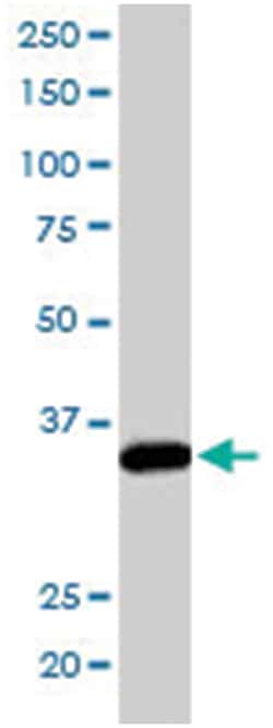 PPP2CA/PPP2CB, Goat, Polyclonal Antibody, Abnova 100&mu;g; Unlabeled:Antibodies,