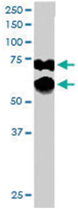 PPP2R5D, Goat, Polyclonal Antibody, Abnova 100 &mu;g | Buy Online | Abnova Corporation | Fisher Scientific