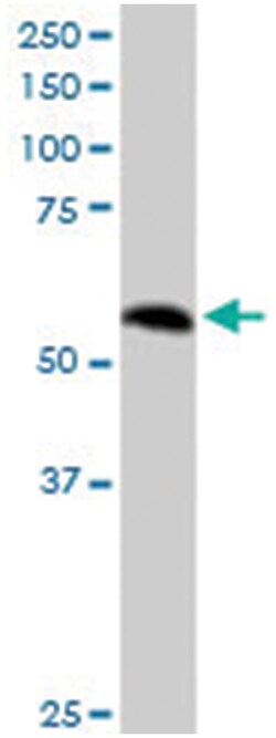 PPP2R5A, Goat, Polyclonal Antibody, Abnova 100 &mu;g | Buy Online | Abnova Corporation | Fisher Scientific