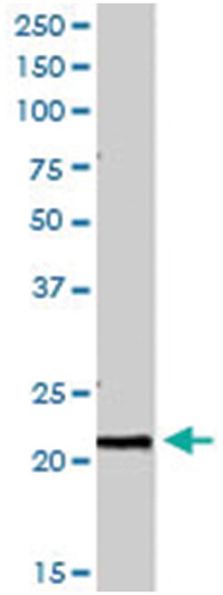 PTP4A1 Goat anti-Human, Polyclonal Antibody, Abnova 100&mu;g; Unlabeled:Antibodies,