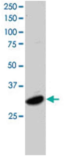 ATF7, Goat, Polyclonal Antibody, Abnova 100 &mu;g | Buy Online | Abnova | Fisher Scientific