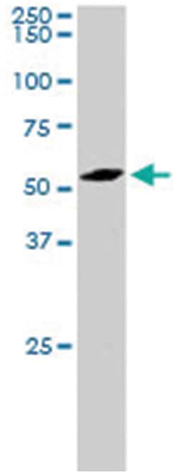PLRG1, Goat, Polyclonal Antibody, Abnova 100 &mu;g | Buy Online | Abnova Corporation | Fisher Scientific