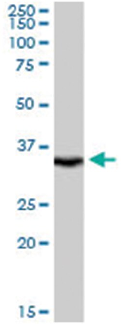 LASP1 Goat anti-Human, Polyclonal Antibody, Abnova 100 &mu;g | Buy Online | Abnova Corporation | Fisher Scientific