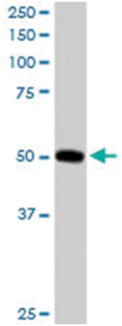 PACSIN3, Goat, Polyclonal Antibody, Abnova 100&mu;g; Unlabeled:Antibodies,