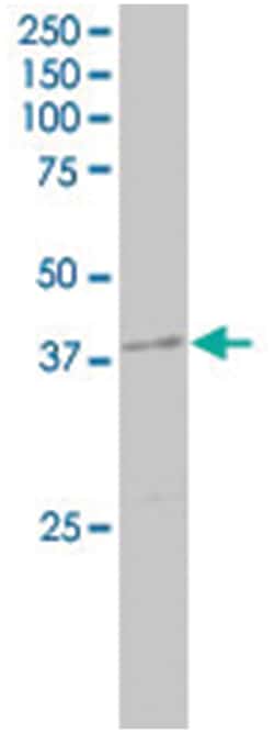 DAPK2, Goat, Polyclonal Antibody, Abnova 100 &mu;g | Buy Online | Abnova Corporation | Fisher Scientific