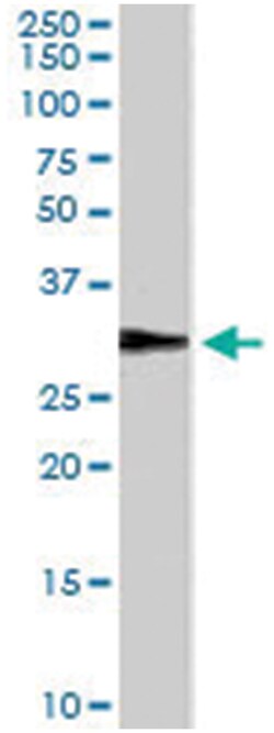 DDAH2, Goat, Polyclonal Antibody, Abnova 100 &mu;g | Buy Online | Abnova Corporation | Fisher Scientific