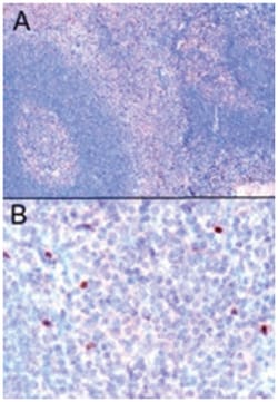 FOXP3, Goat, Polyclonal Antibody, Abnova 100 &mu;g | Buy Online | Abnova Corporation | Fisher Scientific